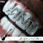 اهنگ کبرا ۱۱ (اینا جلوم دولا راستن بهت میدیم هشدار کبری ۱۱ ریمیکس) بیگ شگی حسین تی ام ریمیکس